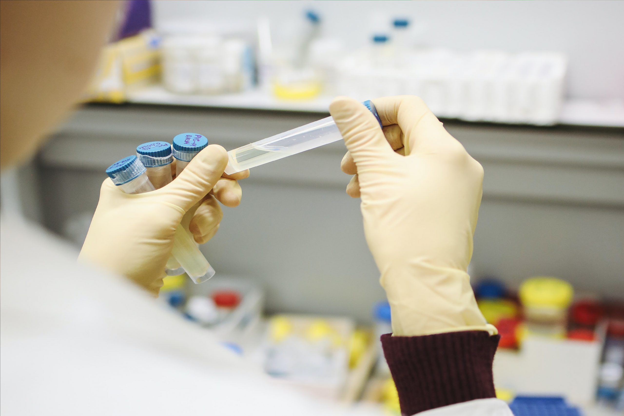 שיטות ואופן הטיפול