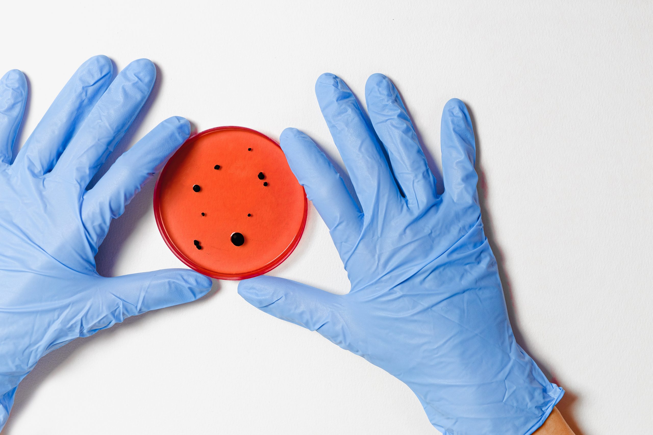 טיפול במחלת דושן באמצעות שיטת ה- CRISPR/Cas9